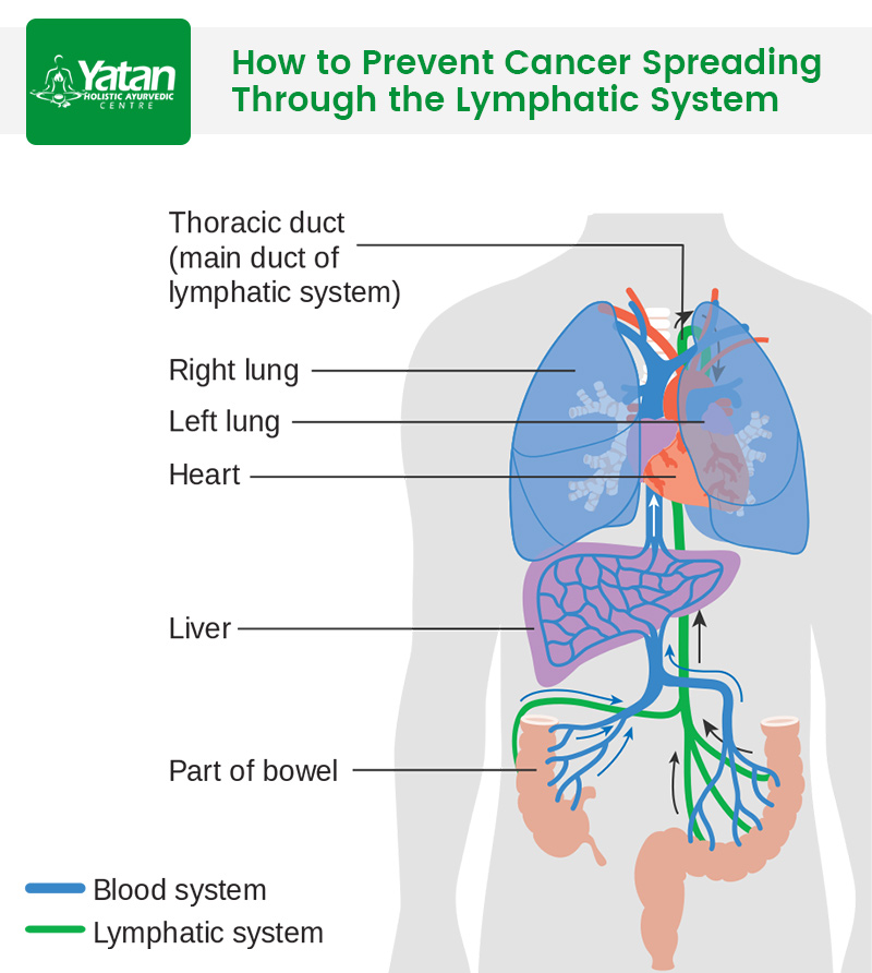 how does the lymphatic system both help and hinder the spread of cancer through the body The effects of radiation therapy on the lymphatic system: acute and latent effects by brian d lawenda, md, and tammy e. how does the lymphatic system both help and hinder the spread of cancer through the body The effects of radiation therapy on the lymphatic system: acute and latent effects by brian d lawenda, md, and tammy e.