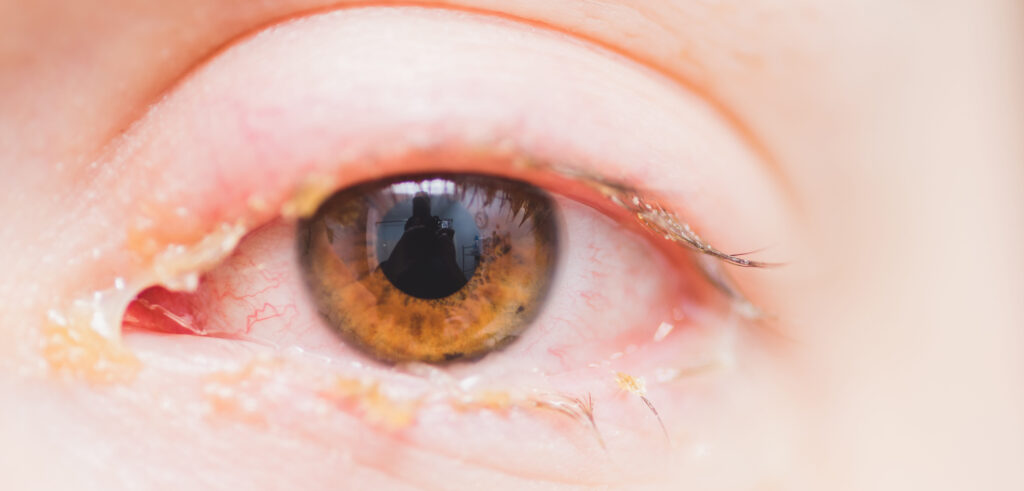 AdobeStock 197229273 edited