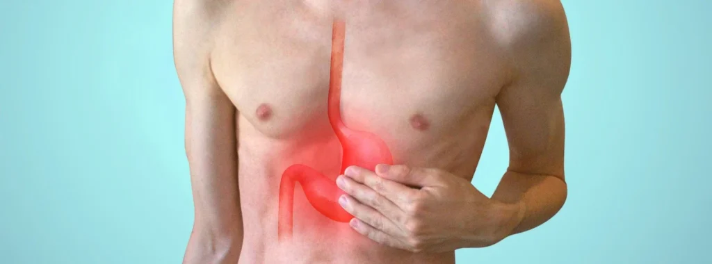 acid reflux