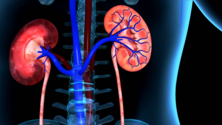 Kidney Detox All You Need to Know
