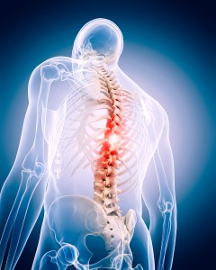 Signs and Symptoms of Ankylosing Spondylitis