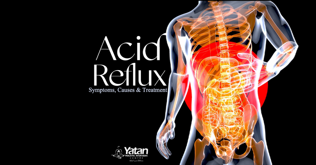 acid reflux