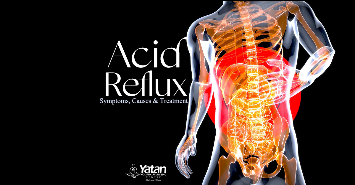 Acid Reflux Your Most Faq Answered By An Ayurvedic Practitioner Acid Reflux Your Most Faq Answered By An Ayurvedic Practitioner