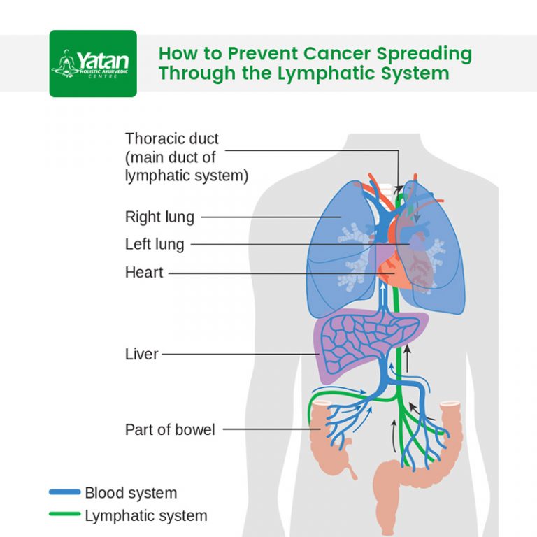 How To Prevent Cancer Spreading Through The Lymphatic System