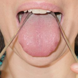 Tongue Scraper | Stainless Steel