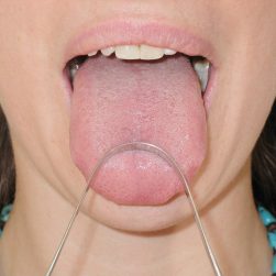 Tongue Scraper | Stainless Steel