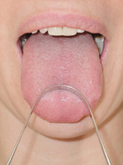 Tongue Scraper | Stainless Steel